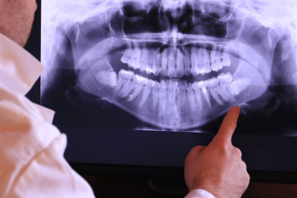 Best Broken Tooth Emergency  in Rutherford, NJ